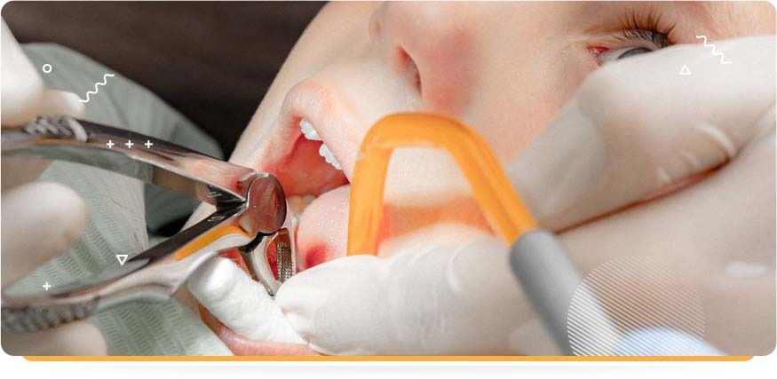 Лечение детских зубов во сне для иногородних